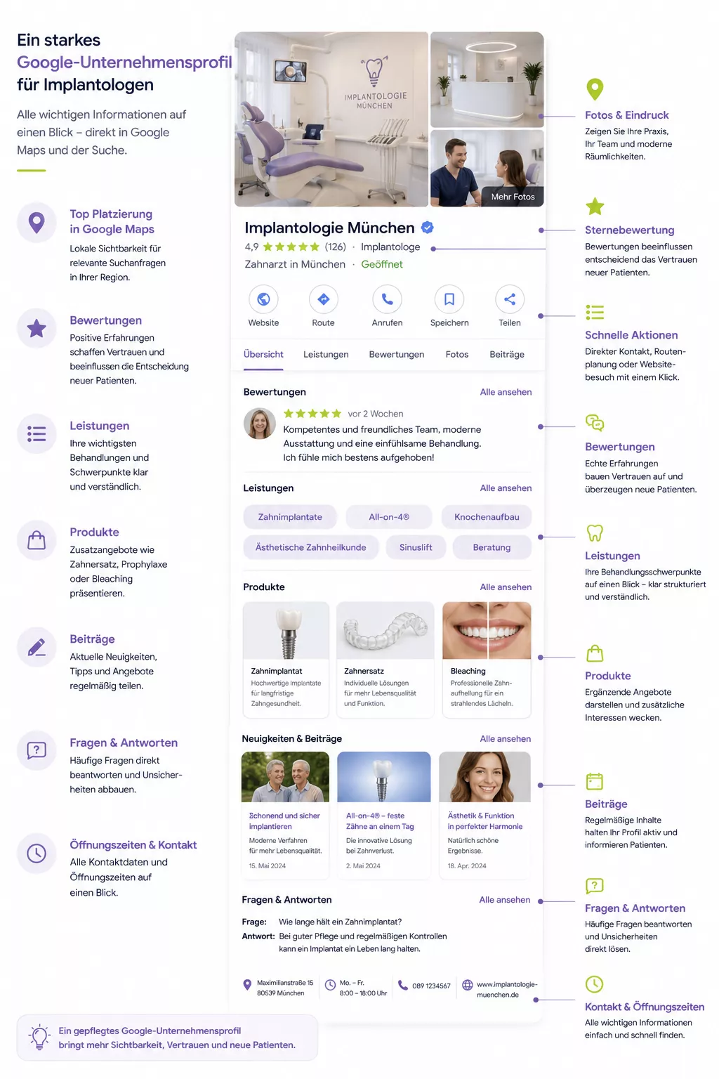 Illustration eines optimierten Google-Unternehmensprofils für eine Implantologie-Praxis. Hervorgehoben werden Fotos, Bewertungen, Leistungen, Produkte, Beiträge, Fragen und Antworten sowie Kontakt- und Standortinformationen.